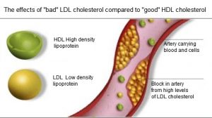 ldl-vs-hdl-cholesterol