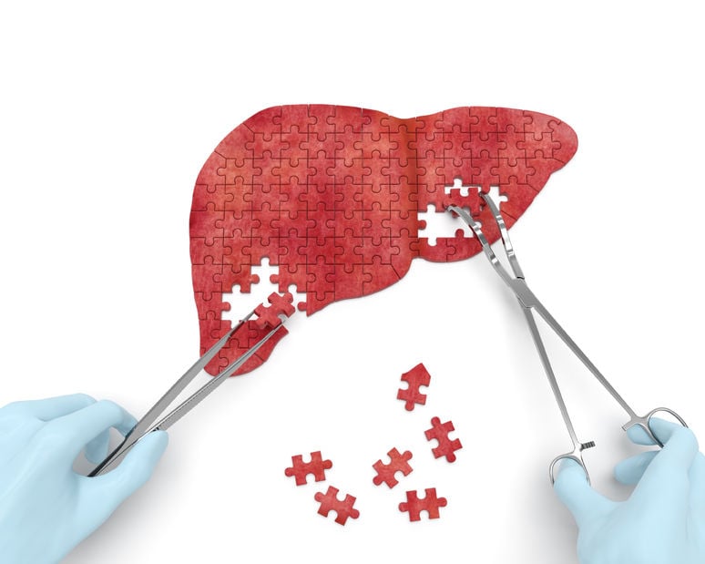 fatty liver | Princeton Nutrients